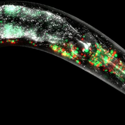 Mitochondria labelled by fluorescent red, and green proteins in the neurons.